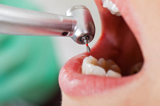 Emergency Dentist for Kids in NY